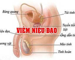 viem-nieu-dao-co-the-gay-vo-sinh-nam-gioi-cho-coi-thuong