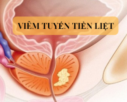 viem-tuyen-tien-liet-man-tinh